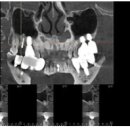 캘리포니아미형 이미지