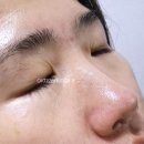 HCBcoop 보습크림 사용 후기, 속건조, 홍조 고민 끝!