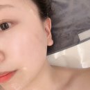 예진약국 | 상암피부관리 윤곽리프팅케어 잘하는곳 포아유에스테틱