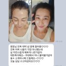 m헤어 | 천안 성성동 헤어라인, 천안 M자 탈모 고민 자연스럽게 채운 후기