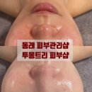 몽트리에 | 동래피부관리 부산여드름관리 투몽트리피부샵