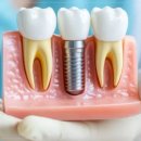 이플랜트치과의원 이미지