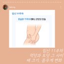 장덕한방병원 구내식당 | 11주차 증상] 먹덧과 토덧 사이 배크기, 입덧 완화 음식, 몸무게 변화 리얼 후기! (ft. 양치토 극복기)