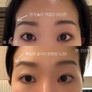 큰산메디칼 | 해운대 피부관리 미인가 만족스러운 경락 후기