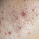 예미안의원 이미지