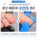 닥터페디 해운대장산점 | 부산 해운대 내성발톱 케어 닥터페디 해운대 장산점 내성발톱 관리 후기