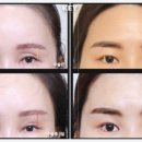 키성형외과의원 이미지