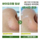 바이오헤드 이미지