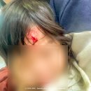 세븐일레븐충주건대병원점 | 16개월 아기 이마 찢어짐 사고 응급처치 후기｜충주 건대병원 응급실