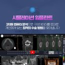 치과 선택의 고민,해결은 여기!강남애프터치과 임플란트 후기