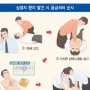 심장마비 전조 효능 및 증상 예방 이미지