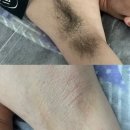 와이쉼터 | 천안겨드랑이왁싱 안 아픈 곳 찾는다면 천안왁싱 와이왁싱 추천해요