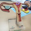 GS25강동성심점 | 1편] 자궁근종수술 병원선택 / 청담산부인과, 강동성심병원, 수술방법 및 수술비 비교 / 점막하근종과...