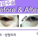 청담진성형외과피부과의원