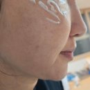 여니약국 | 30대 워킹맘의 출산 후 기미 극복기! 일양약품 기미미백크림 솔직 후기 (약국템, 나이아신아마이드 함유)