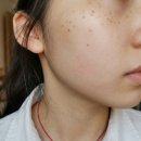 뉴트리코어 하이퍼셀 멜라토닌 앰플 트라넥삼산 세럼 후기