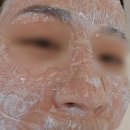 평택 용죽지구 맞춤 피부 관리 광채 맛집 순수에스테틱