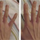 손가락 vs 뼈대 이미지