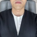 [밴스의원 용산점] 7번째 남성 U라인 제모 후기(feat.여전히 아프다)