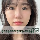 강남미소약국 | 강남 논현동 팔자주름 실리프팅 쥬베룩볼륨 찐후기 유지기간
