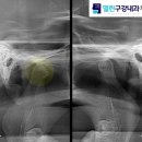 이기호내과의원 | 대구턱관절병원 소식 : 만성 턱관절 환자 관련 기사
