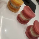 마음편한치과의원 | “부평역 마음편한교정치과 초6 교정상담 후기｜성장판·턱 사진까지 꼼꼼하게”