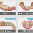 금산치과기공소 이미지