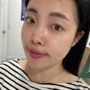 전포 피부관리 예쁘리 블랙헤드 아쿠아필 관리 후기