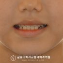 글로리치과교정과치과의원 이미지