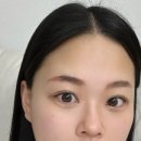 누브의원 이미지