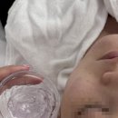 케어메디칼 | 중랑구 사가정 메디컬 여드름케어관리 후기 여드름, 비립종 흉터 없이 관리받고 싶다면 &#39;블리로움 뷰티크&#39;✨️