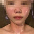 비치코스메틱 | [부산] 남포동피부관리 이영란코스메틱 얼굴경락 후기