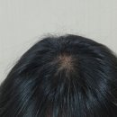탈모영양제 세비톨 토탈케어 포뮬러 비오틴 후기