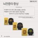 뇌전증 발작, 이럴 땐 119로 신고해주세요! 이미지