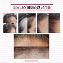 박씨뎐