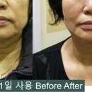 신비체테라피