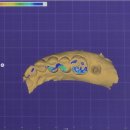 연합치과기공소 이미지