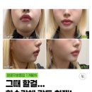 포인트성형외과의원 이미지