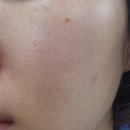 이어케어넷 | 아넷사 스킨케어 모이스처 젤 아넷사선크림 추천 26년 가정의달 세일