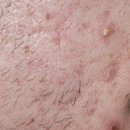 벨아미-리노보의원 이미지