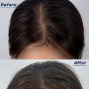 원스칼프 | 부산 전포 여성 탈모 가르마 커버 후기 원스칼프