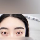 시그노엘 네이버블로그