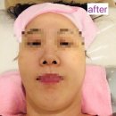 동그라미센터 | 해운대 피부관리 동그라미뷰티센터 다녀 온 후기