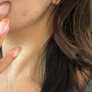 PCK | ✨ DPS 프레시 팩 + 잽 스팟 솔직 후기｜피지·트러블 잠재우는 쿨링 피부진정팩, 여드름 스팟 완전 추천!