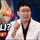 무릎 퇴행성 관절염, 정맥주사가 나을까, 관절강내 직접 주사가 나을까? 이미지