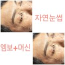 피부미인 이미지