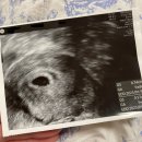 판교가온산부인과의원 이미지