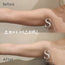 소피아 에스테틱 | 웨딩관리, 신부관리는 소피아에스테틱!(고객님의 솔직한 후기)