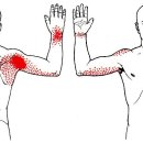 “자세가 통증을 부른다 – 어깨·손목·목 근육의 경고” 이미지
