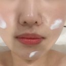 바르떼슈가링